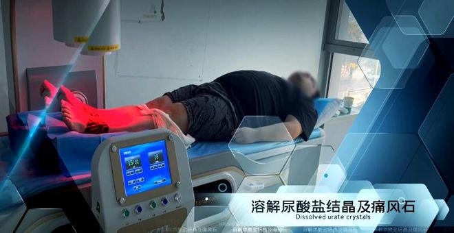 尿酸值忽高忽低致疼痛怎么办？痛风专家周桂兰为你解答！(图5)