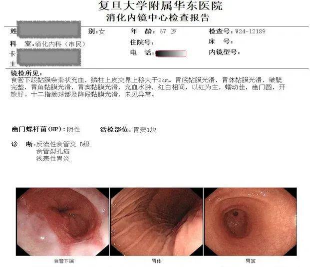 老人反复胸痛竟是胃“跑”进了胸腔？(图1)